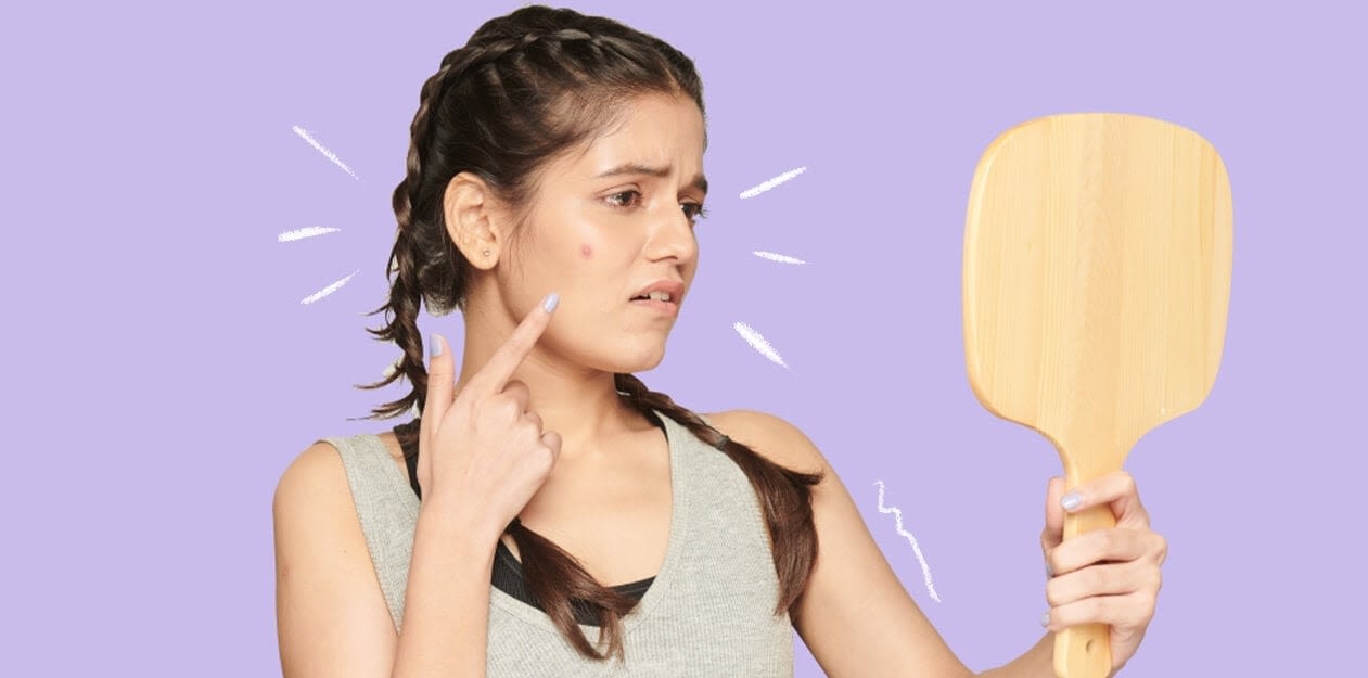 how-to-get-rid-of-acne_main-banner_thum-en-in